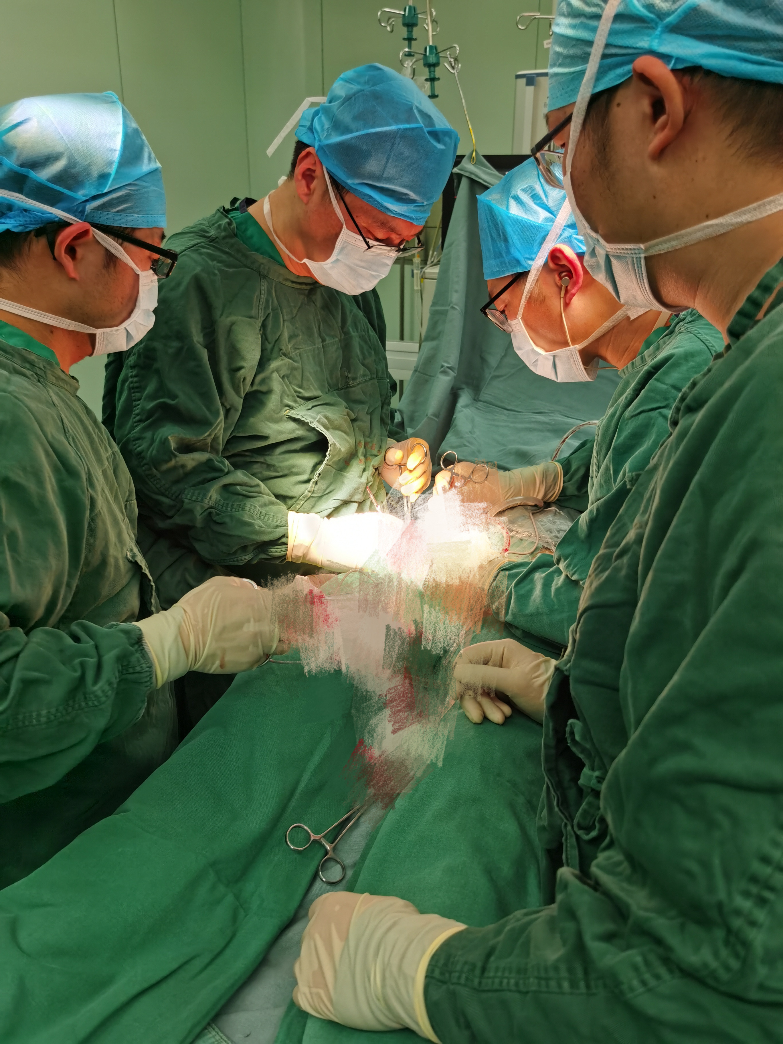 常年用激素股骨头坏死能手术吗,医院用了激素药造成股骨头坏死