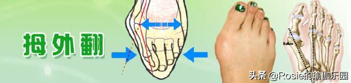 穿高跟鞋膝盖疼痛怎么缓解,穿高跟鞋如何防止脚累疼