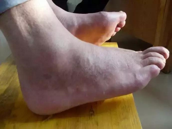 快死的鱼变活鱼，竟然只要往鱼嘴里加点这个就可以实现了