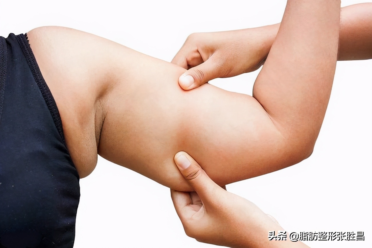 既能瘦手臂又能练出手臂肌肉,瘦手臂最简单健身动作瘦身