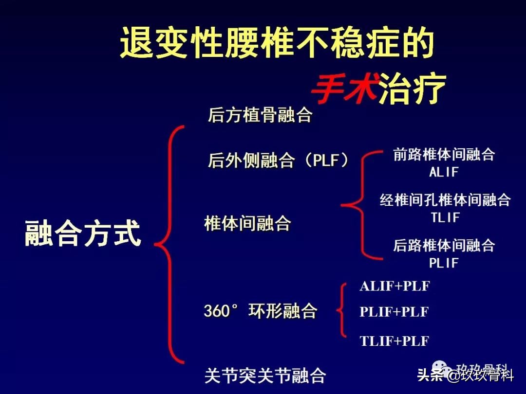 腰椎不稳最坏的结果,腰椎不稳的最佳治疗方法