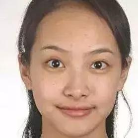 日本的美白针,日本最强美白针