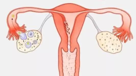 夏季妇科疾病的预防,夏日炎炎女性如何预防妇科疾病