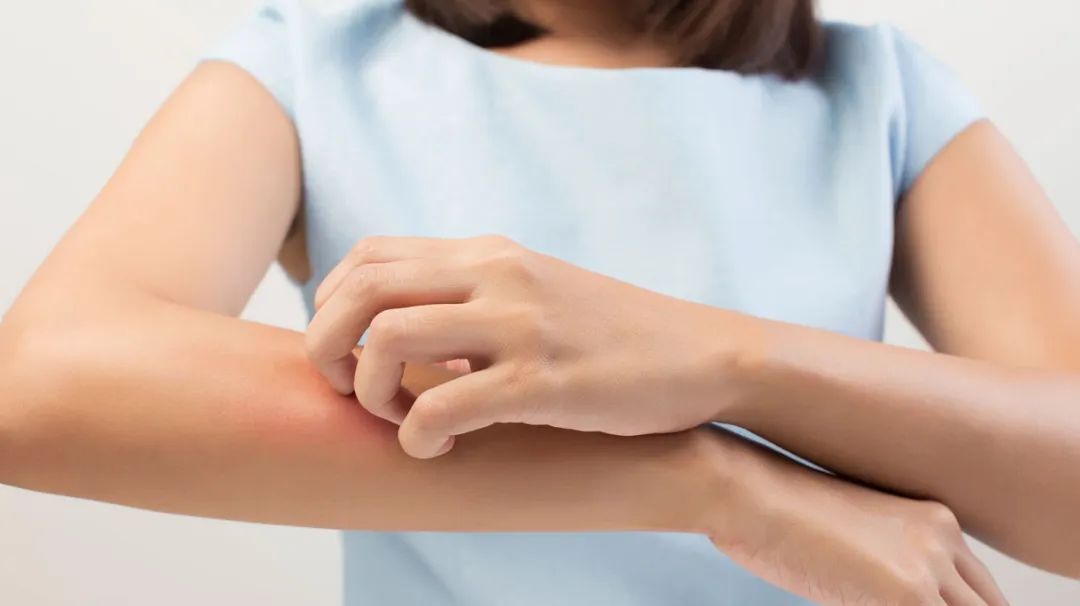 治疗皮肤感染的最佳中药,治皮肤感染特效药