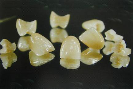 各种假牙价格一览表,假牙十大品牌价格表