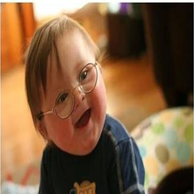 为什么大龄孕妇会容易生唐氏儿,妈妈怀了唐氏儿的孩子怎么办