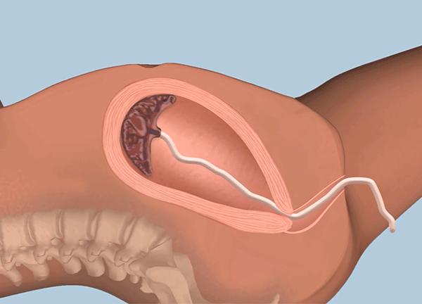 女人生孩子到底有多疼？