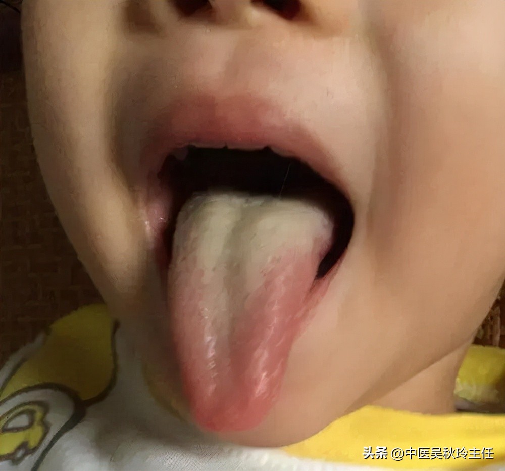 小孩厌食不吃饭该怎么办,孩子厌食不爱吃饭补锌