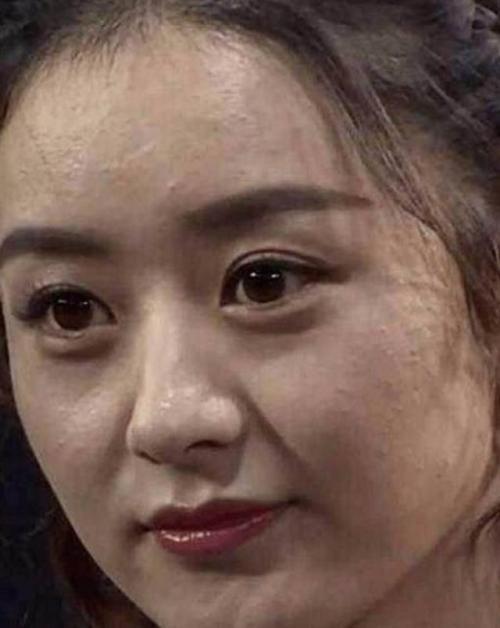 混油痘用什么卸妆品好,皮肤出油长痘严重如何改善