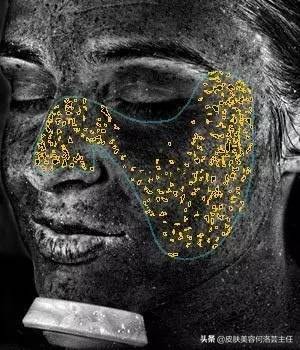 visia皮肤检测是什么原理,visia皮肤检测值多少是正常的