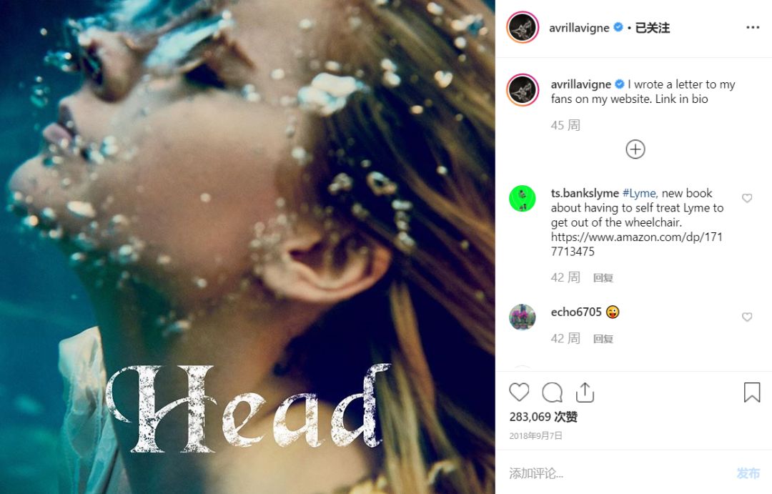 2016-2017格莱美,格莱美死亡搁浅