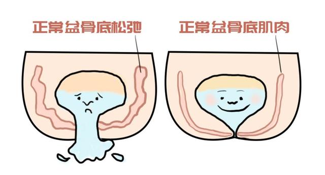 产后恢复包含哪些项目,产后恢复都包含哪些项目