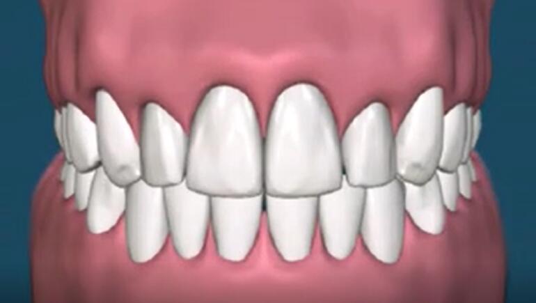 狗狗洗牙的良心忠告,医生忠告千万别洗牙