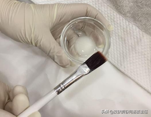 去黑头的方法快速有效,去除黑头以后皮肤该如何护理