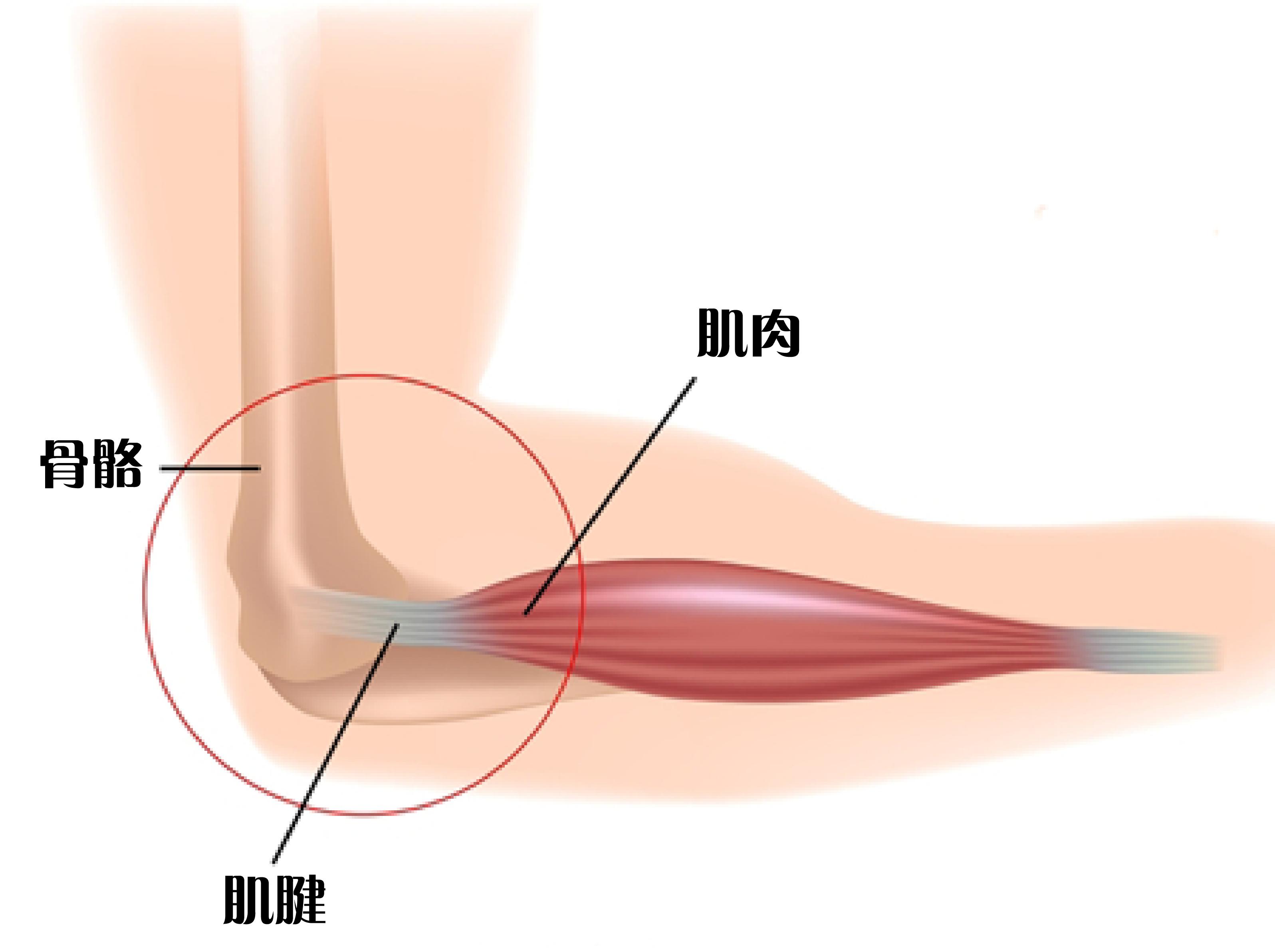 25%的人手臂中都会缺少一块肌肉：看看你也是这样吗？