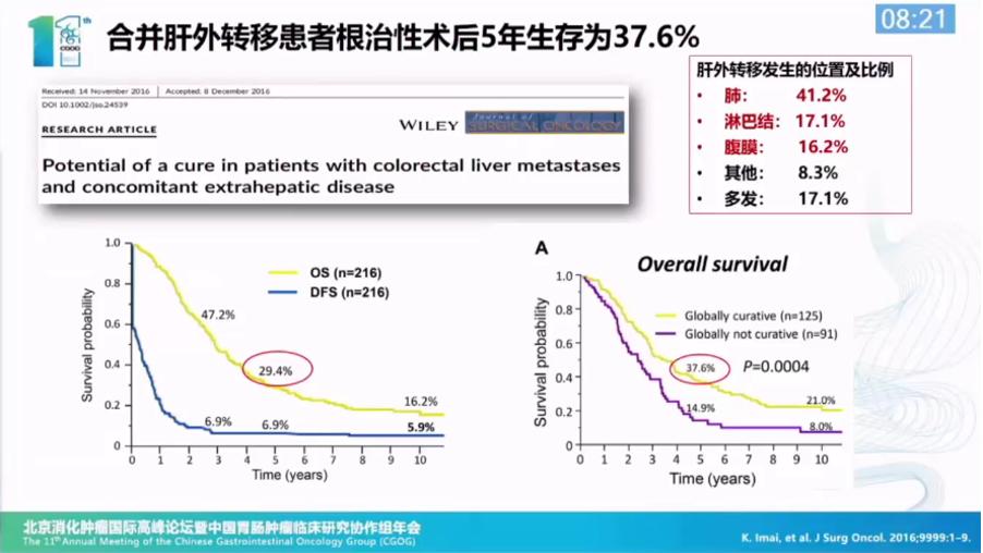 刘静肠癌,刘静教授医生