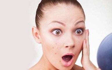 有什么祛痘印的方法,祛红痘印最好的方法