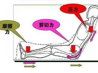 压疮和褥疮是一回事吗,压疮褥疮是一回事吗
