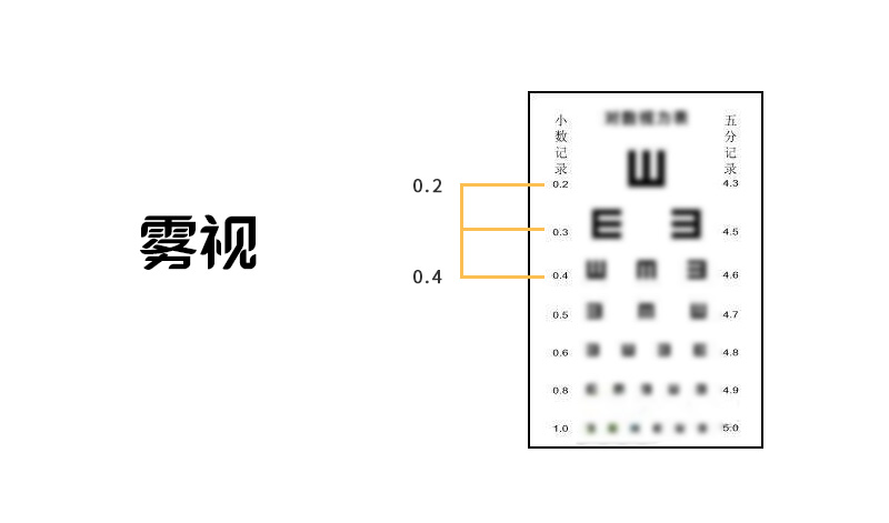 网上配镜如何完善视力档案,网上配镜检查视力流程