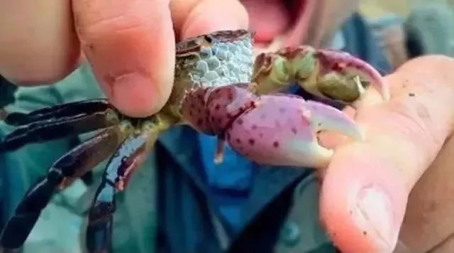 女童抠破“小红疙瘩”致下肢坏死，3次手术保命！医生：出现这些症状别不在意