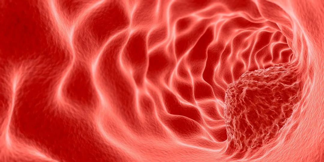 cea和ca199能查出来癌症吗,癌症检查指标ca199你了解多少