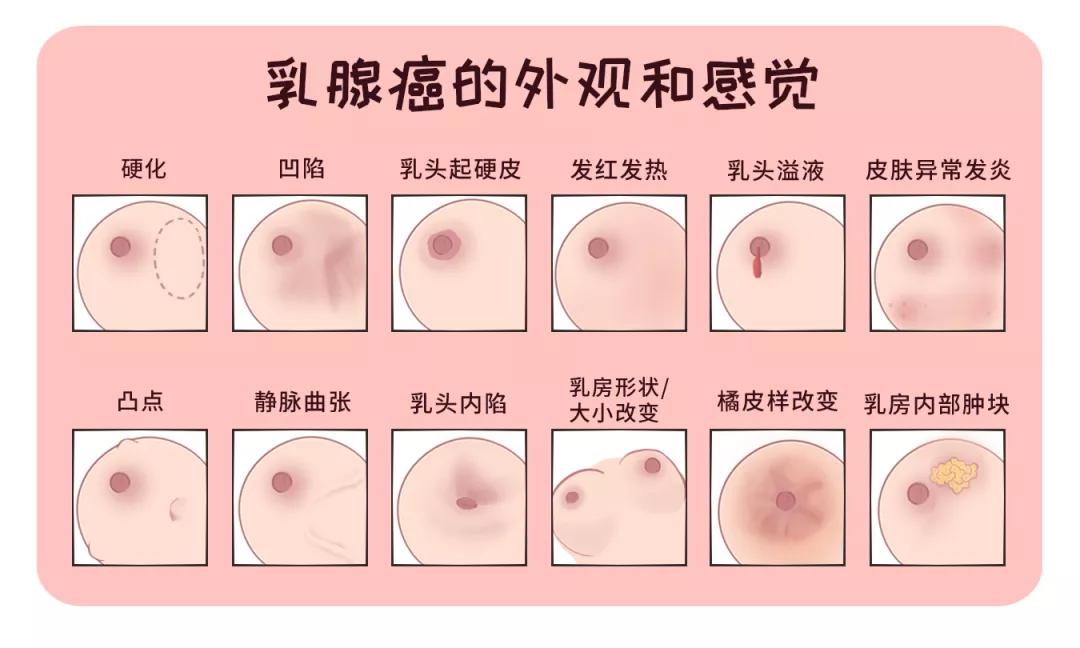 2020女性癌症排行榜图,2021年癌症杀手大数据