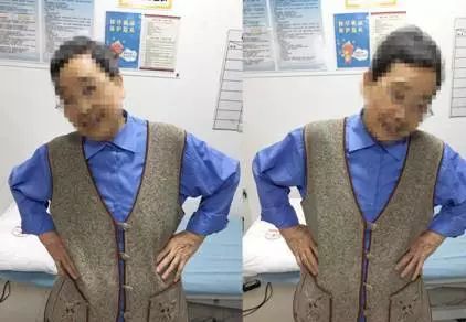 帕金森病运动康复训练操,帕金森患者的运动康复锻炼