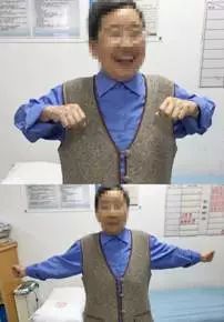 帕金森病运动康复训练操,帕金森患者的运动康复锻炼