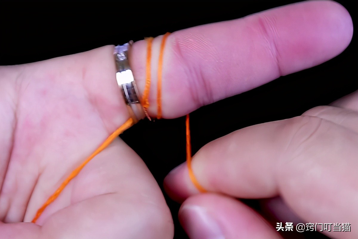 戒指戴太紧取不出来怎么办,戒指戴久了摘不下来用薄膜的方法