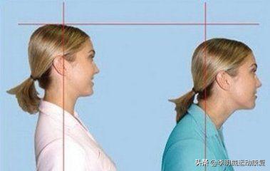 富贵包怎么消除最好方子,富贵包怎么消除视频教学