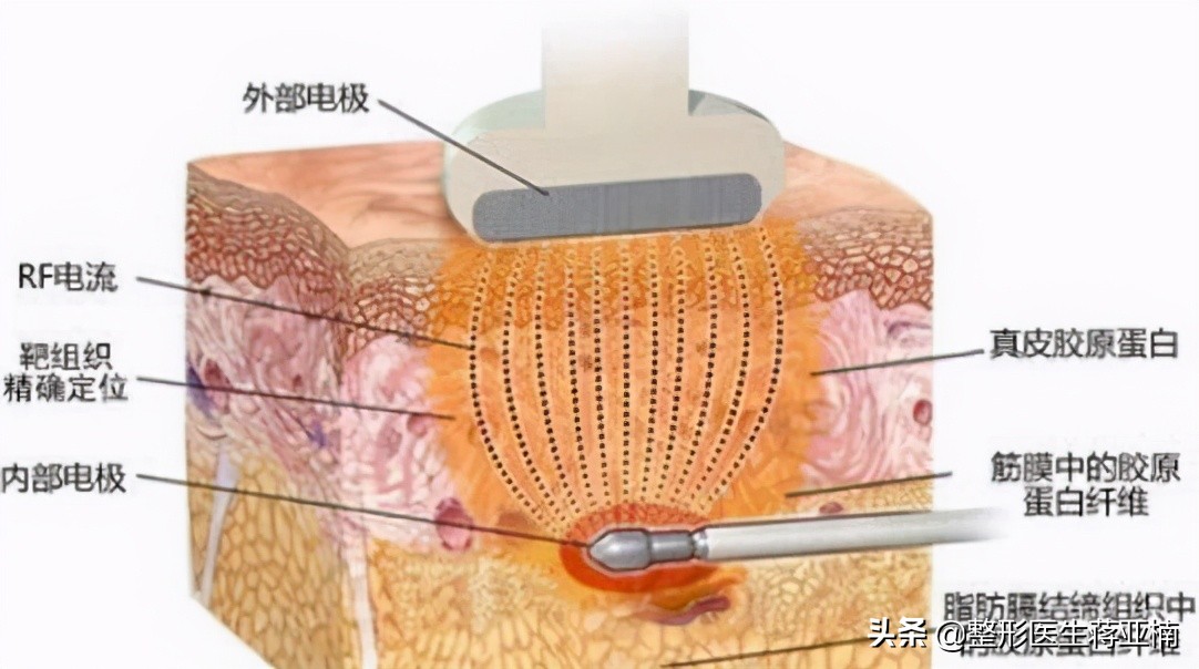 一次性说清,一次性说清一维到十维