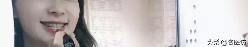 戴牙套2年不戴保持器反弹案例,戴牙套成功案例不戴保持器