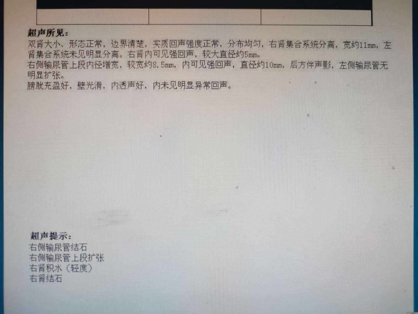 腰疼小肚子疼是什么结石,腰疼结石是怎么回事