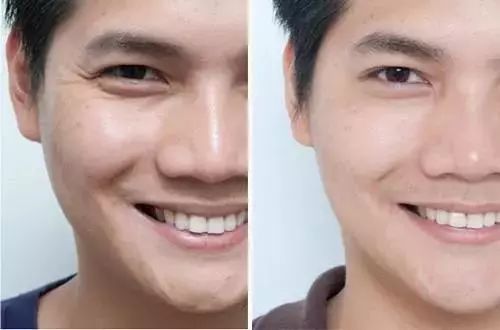 抗皱纹抗老小妙招,30岁后的面部抗老思路