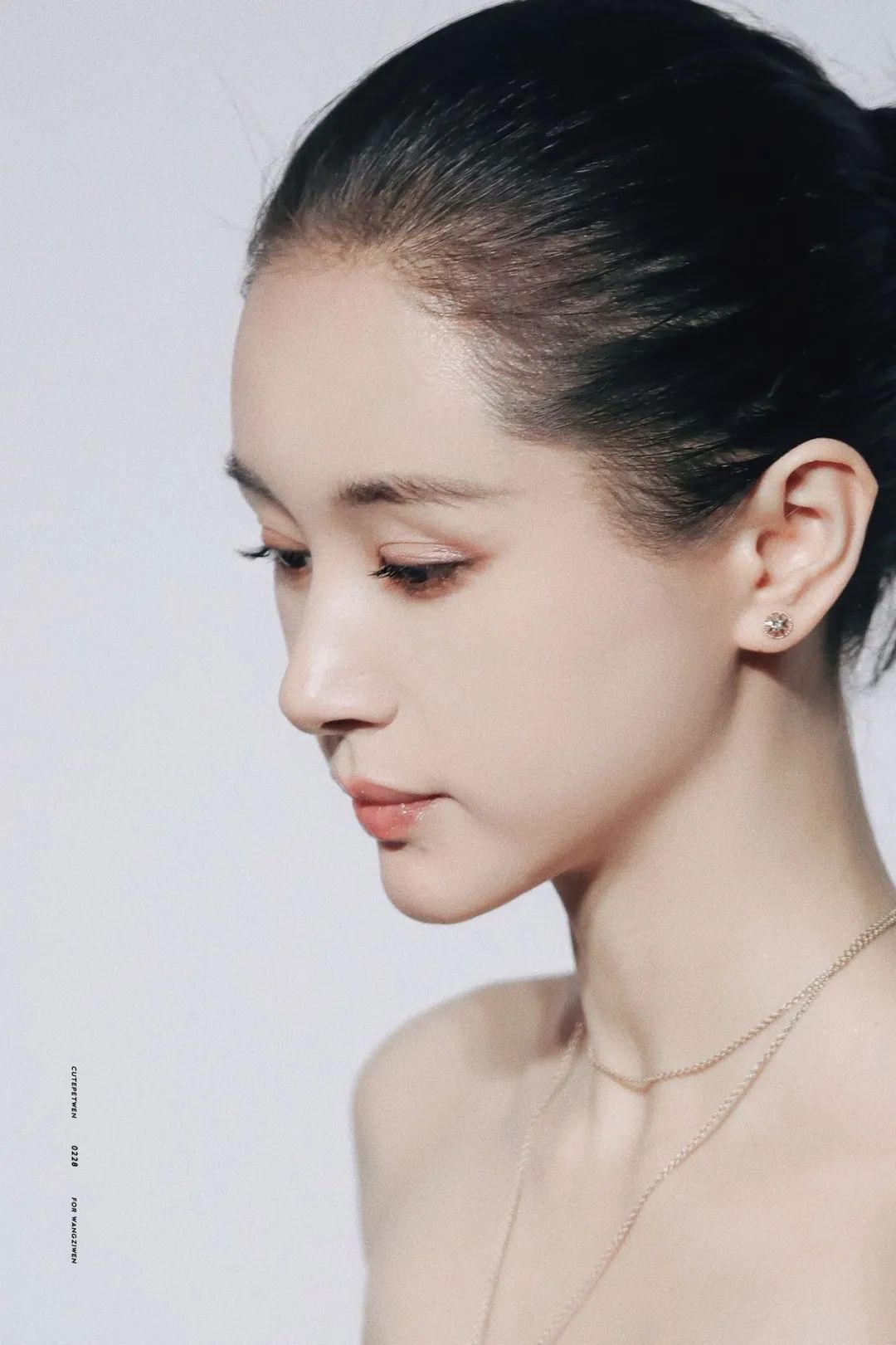 娄艺潇填充脂肪前后对比,娄艺潇填充前后对比