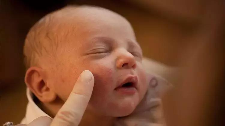 宝宝屁股红点一般是湿疹还是热疹,宝贝脸上有红点点是湿疹还是热疹