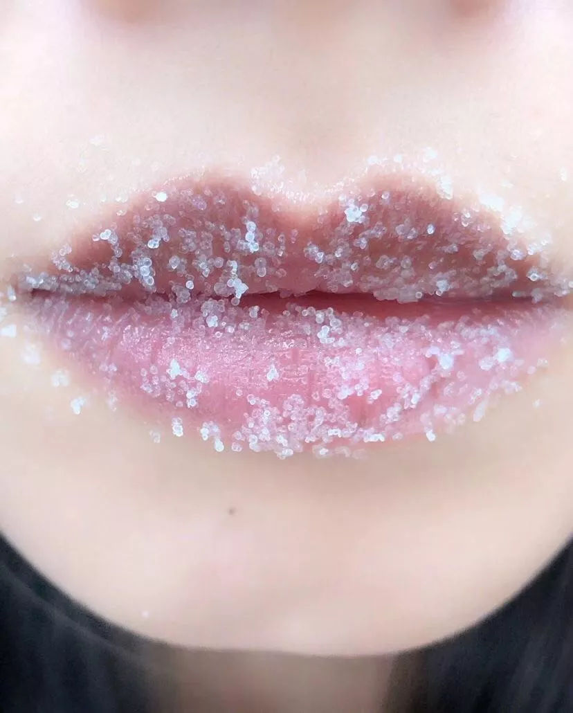 黑头皮肤屏障脆弱容易色素沉着,皮肤黑头闭口暗沉