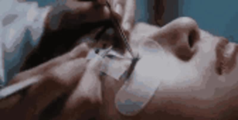 睫毛也能烫,睫毛可以烫了再种吗