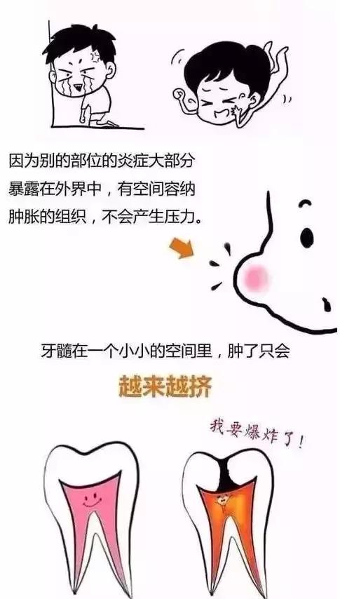 怎么判断各种牙痛,牙痛视频分析