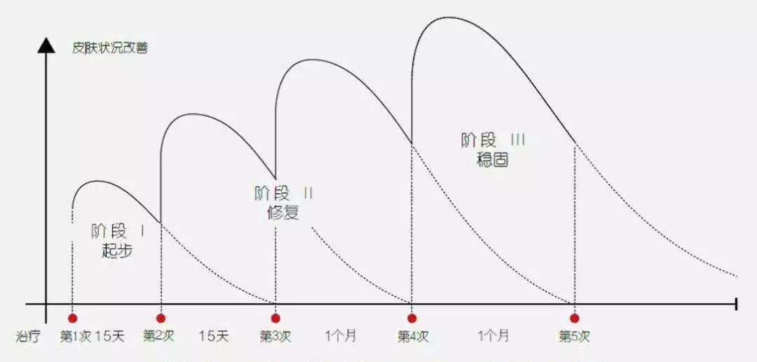 水光针真的比面膜好吗,1次水光等于1000张面膜
