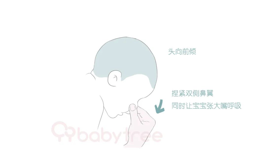 小孩鼻子受伤多久能修复,宝宝鼻子受伤还能恢复不