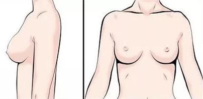 如何选择适合自己的内衣款式,如何选择适合自己的内衣图解