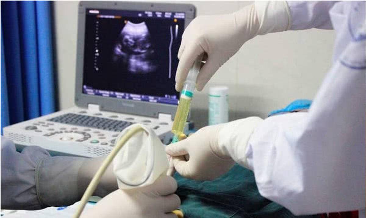 好奇！羊水穿刺留下的针眼会不会漏水？