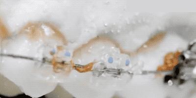 洗牙会导致牙齿敏感吗,洗牙伤害了牙釉质