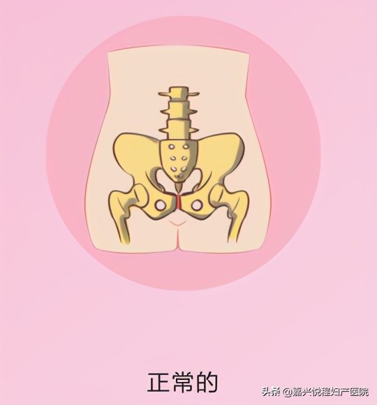 产后恢复怀孕,产后恢复让你紧致如初