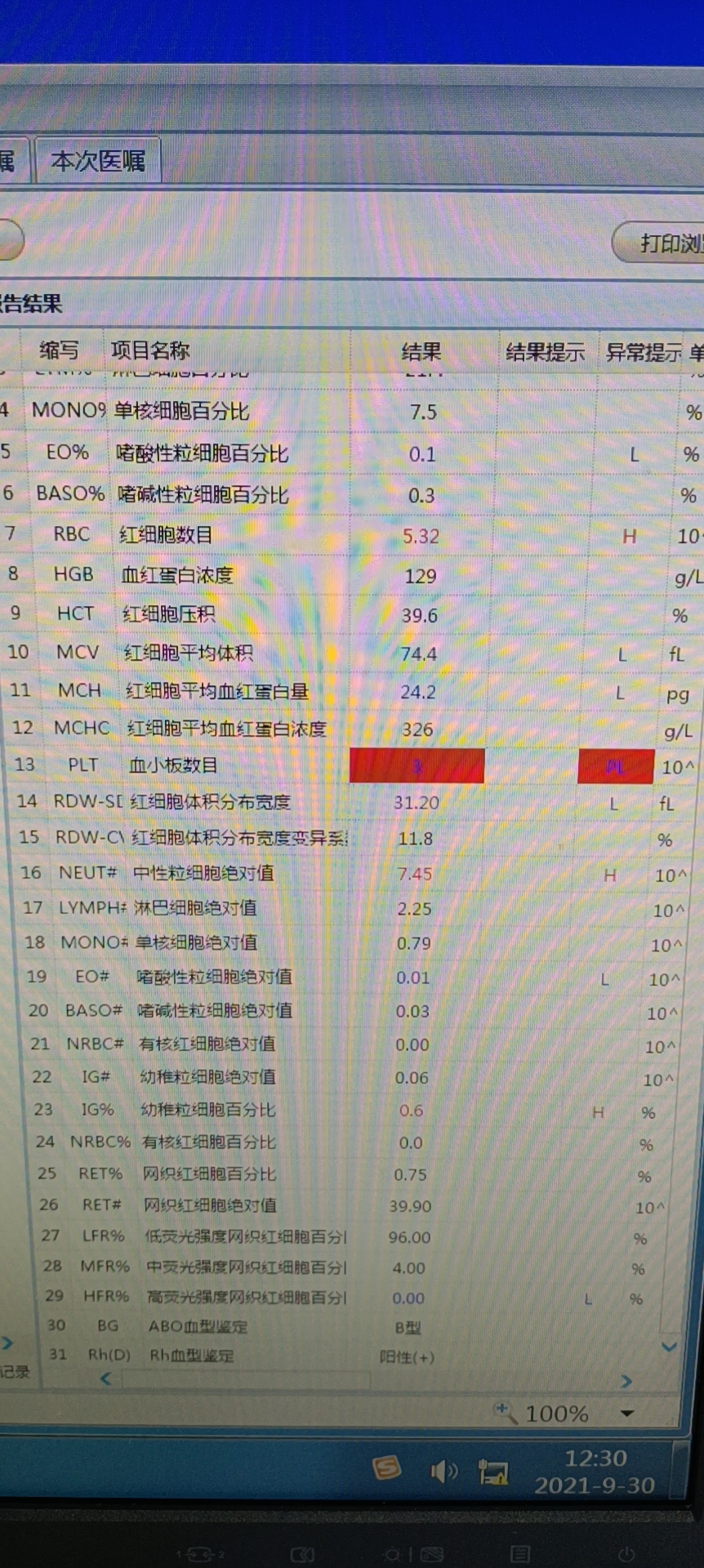 2岁男童感冒后发现血小板减少,经治疗后康复