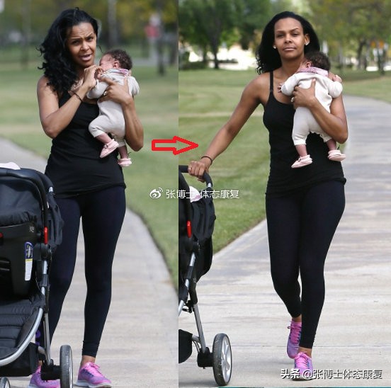【案例分析】宝妈经常单手抱孩子腰痛怎么破,这篇文章会告诉你