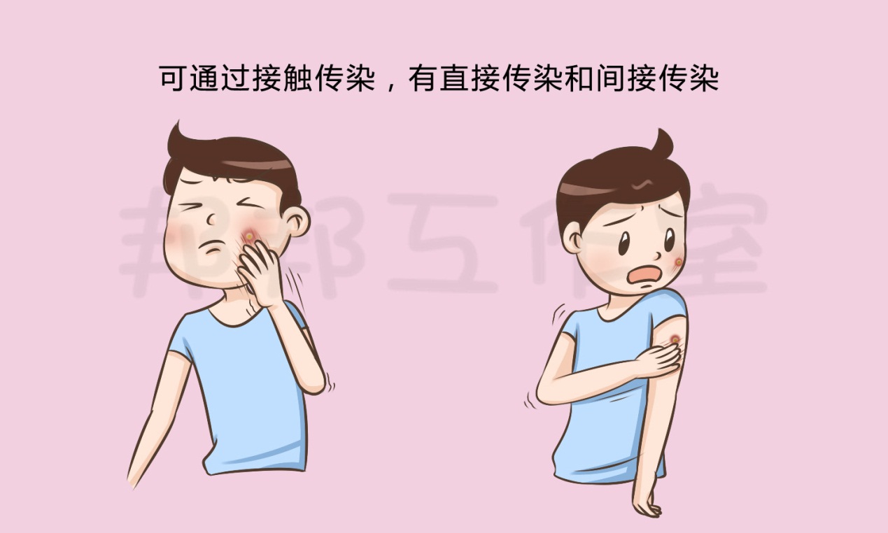 脸上长的瘊子会传染吗,脸上长瘊子用剪刀剪掉就好了