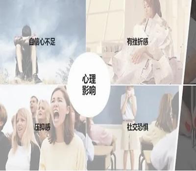 手心汗流不止！随着年龄增长，会好吗？医生：别大意