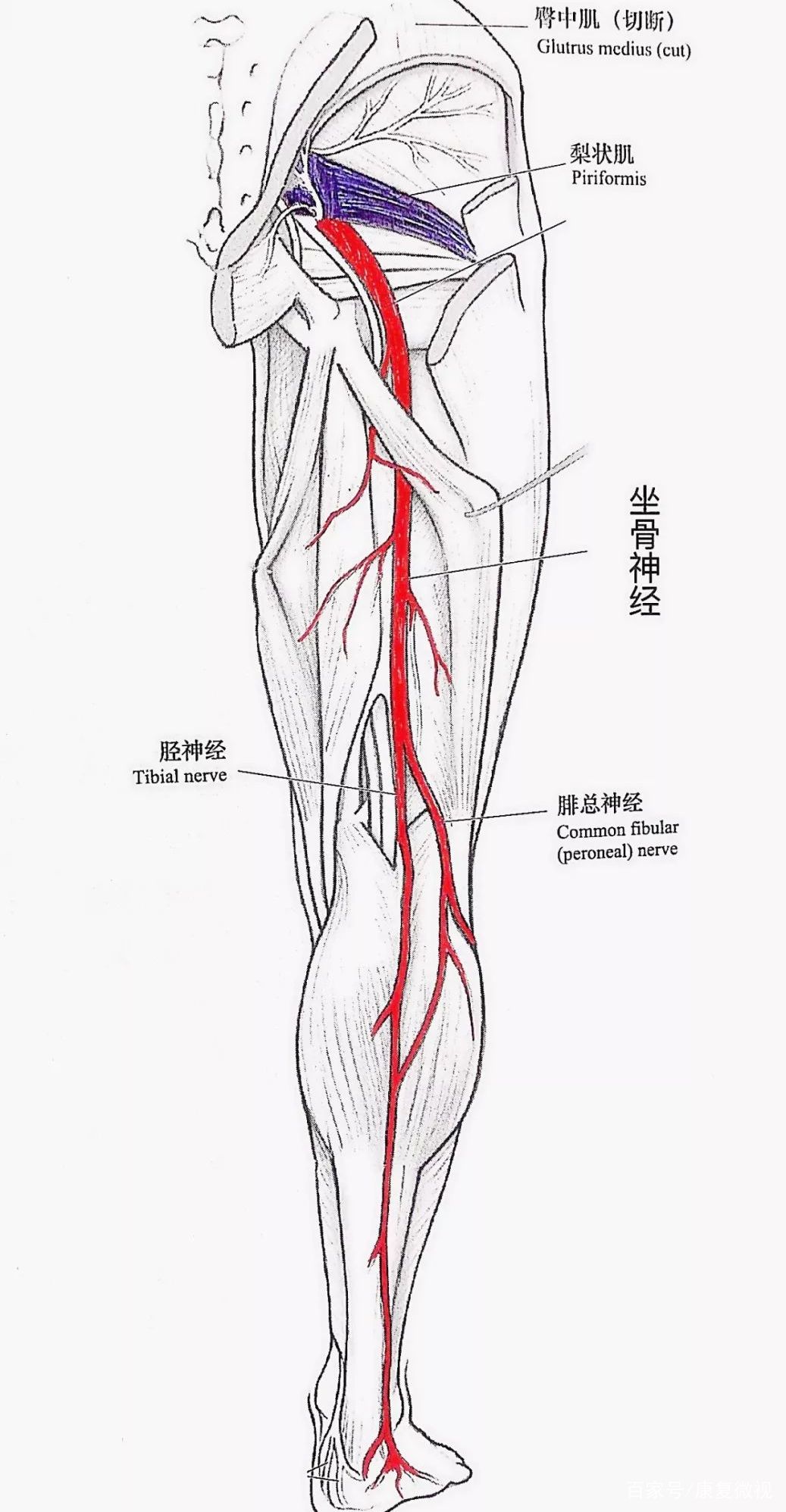 椎间盘突出腰腿疼消失,椎间盘突出腰腿痛能根治吗